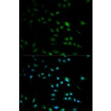 Immunofluorescence - IFNB1 Antibody from Signalway Antibody (32320) - Antibodies.com