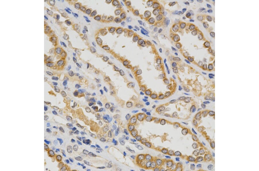 Immunohistochemistry - IFNB1 Antibody from Signalway Antibody (32320) - Antibodies.com