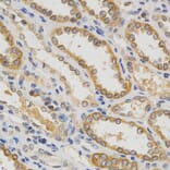 Immunohistochemistry - IFNB1 Antibody from Signalway Antibody (32320) - Antibodies.com