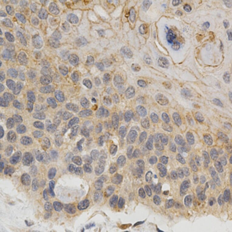 Immunohistochemistry - IFNB1 Antibody from Signalway Antibody (32320) - Antibodies.com