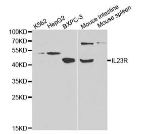 Western blot - IL23R Antibody from Signalway Antibody (32341) - Antibodies.com