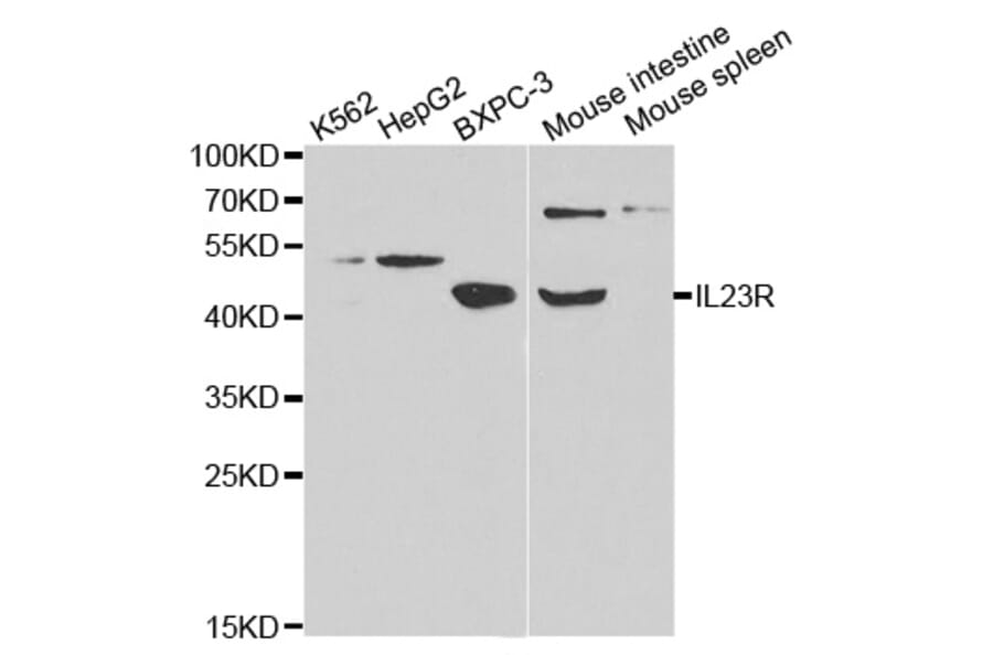 Western blot - IL23R Antibody from Signalway Antibody (32341) - Antibodies.com