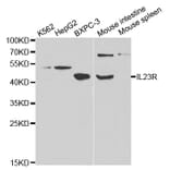 Western blot - IL23R Antibody from Signalway Antibody (32341) - Antibodies.com