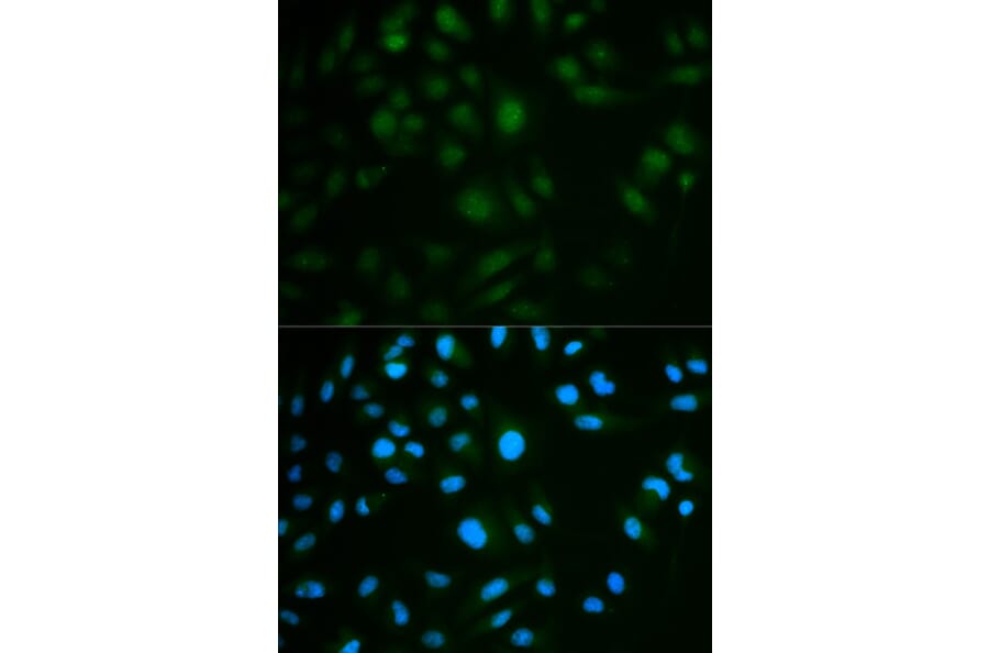 Immunofluorescence - IL23R Antibody from Signalway Antibody (32341) - Antibodies.com