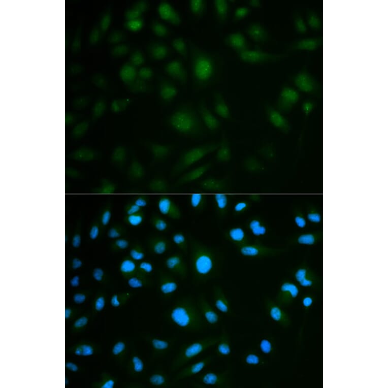 Immunofluorescence - IL23R Antibody from Signalway Antibody (32341) - Antibodies.com