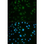 Immunofluorescence - IL23R Antibody from Signalway Antibody (32341) - Antibodies.com
