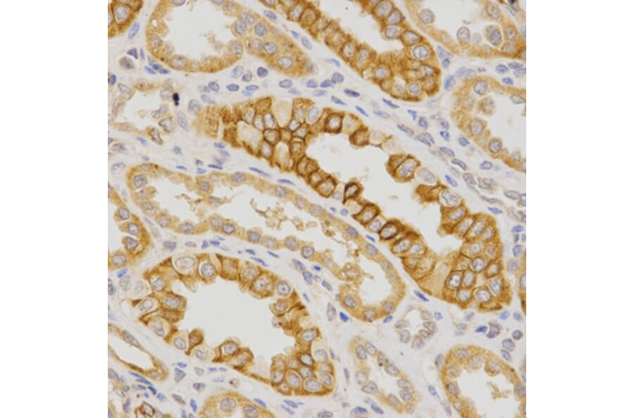 Immunohistochemistry - IL23R Antibody from Signalway Antibody (32341) - Antibodies.com