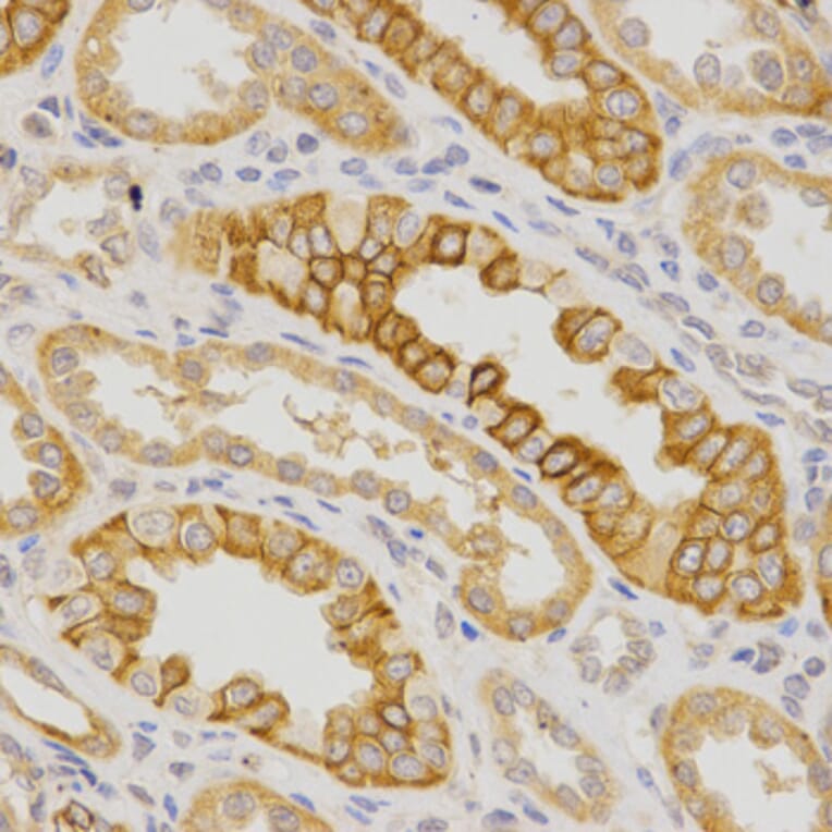 Immunohistochemistry - IL23R Antibody from Signalway Antibody (32341) - Antibodies.com