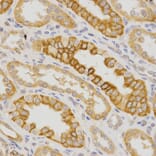 Immunohistochemistry - IL23R Antibody from Signalway Antibody (32341) - Antibodies.com