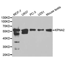 Western blot - KPNA2 Antibody from Signalway Antibody (32349) - Antibodies.com