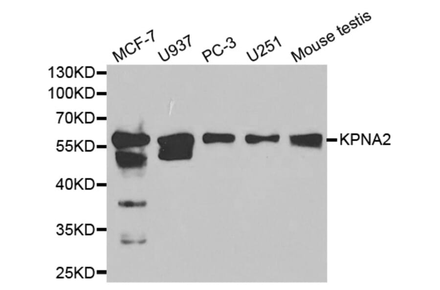 Western blot - KPNA2 Antibody from Signalway Antibody (32349) - Antibodies.com