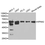 Western blot - KPNA2 Antibody from Signalway Antibody (32349) - Antibodies.com