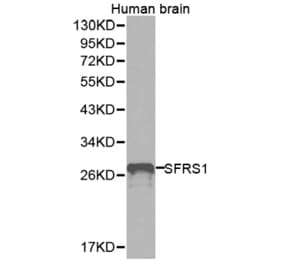 Western blot - SFRS1 Antibody from Signalway Antibody (32366) - Antibodies.com