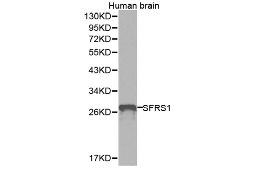 Western blot - SFRS1 Antibody from Signalway Antibody (32366) - Antibodies.com