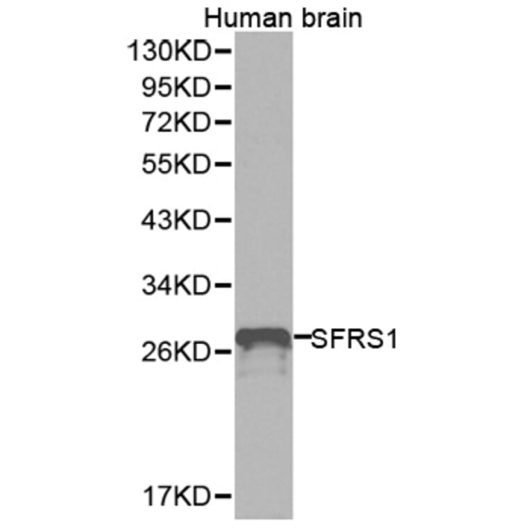 Western blot - SFRS1 Antibody from Signalway Antibody (32366) - Antibodies.com
