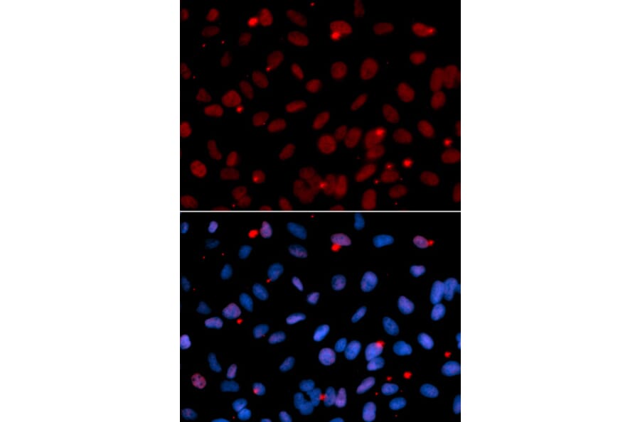 Immunofluorescence - SFRS1 Antibody from Signalway Antibody (32366) - Antibodies.com