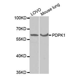 Western blot - PDPK1 Antibody from Signalway Antibody (32375) - Antibodies.com