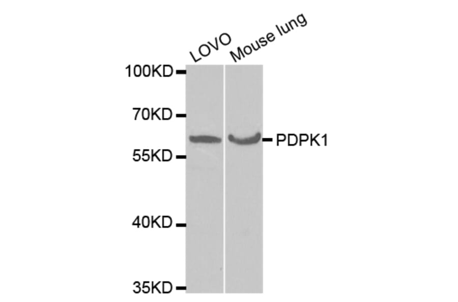 Western blot - PDPK1 Antibody from Signalway Antibody (32375) - Antibodies.com