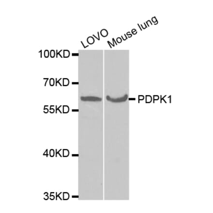 Western blot - PDPK1 Antibody from Signalway Antibody (32375) - Antibodies.com