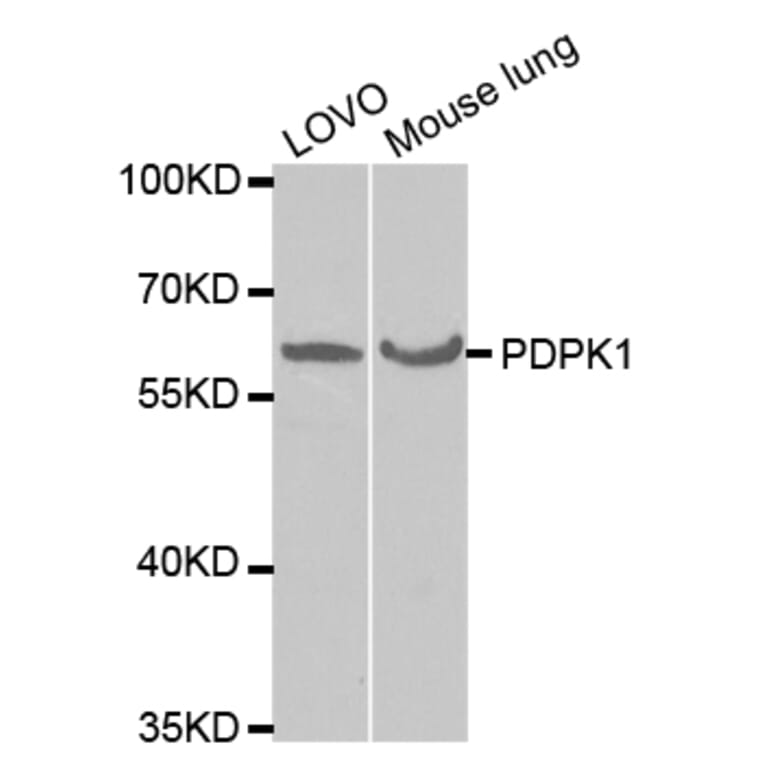 Western blot - PDPK1 Antibody from Signalway Antibody (32375) - Antibodies.com