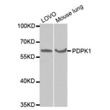 Western blot - PDPK1 Antibody from Signalway Antibody (32375) - Antibodies.com