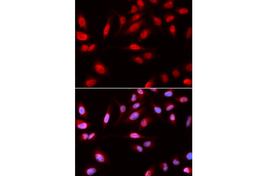 Immunofluorescence - PDPK1 Antibody from Signalway Antibody (32375) - Antibodies.com