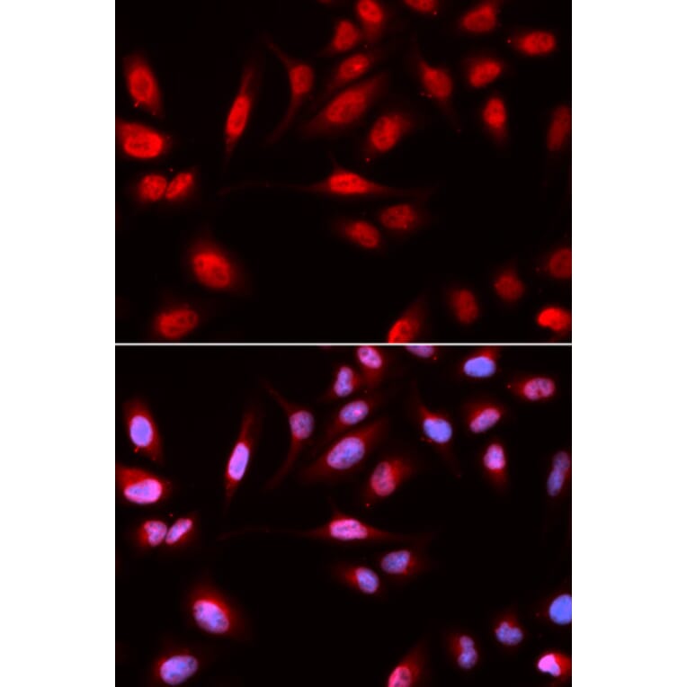 Immunofluorescence - PDPK1 Antibody from Signalway Antibody (32375) - Antibodies.com