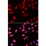 Immunofluorescence - PDPK1 Antibody from Signalway Antibody (32375) - Antibodies.com