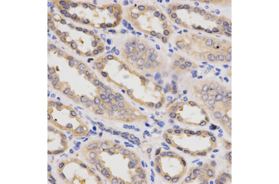 Immunohistochemistry - PDPK1 Antibody from Signalway Antibody (32375) - Antibodies.com