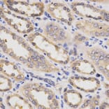 Immunohistochemistry - PDPK1 Antibody from Signalway Antibody (32375) - Antibodies.com