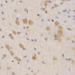 Immunohistochemistry - PDPK1 Antibody from Signalway Antibody (32375) - Antibodies.com