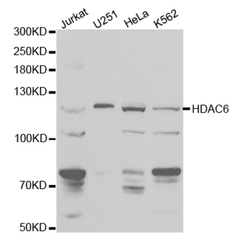 Western blot - HDAC6 Antibody from Signalway Antibody (32406) - Antibodies.com