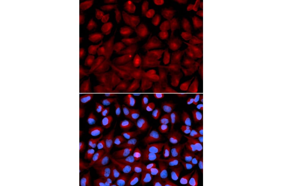 Immunofluorescence - HDAC6 Antibody from Signalway Antibody (32406) - Antibodies.com
