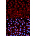 Immunofluorescence - HDAC6 Antibody from Signalway Antibody (32406) - Antibodies.com