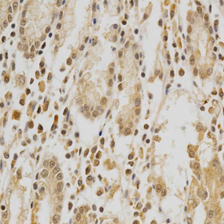 Immunohistochemistry - HDAC6 Antibody from Signalway Antibody (32406) - Antibodies.com