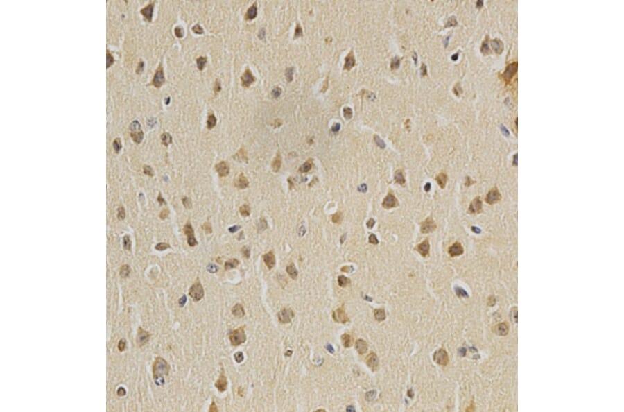 Immunohistochemistry - HDAC6 Antibody from Signalway Antibody (32406) - Antibodies.com
