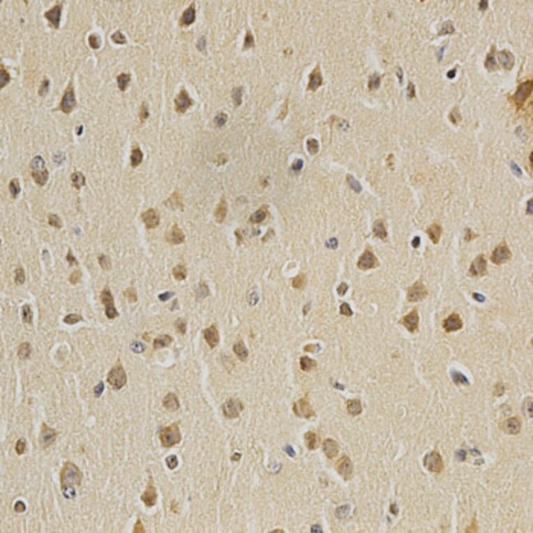 Immunohistochemistry - HDAC6 Antibody from Signalway Antibody (32406) - Antibodies.com