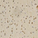 Immunohistochemistry - HDAC6 Antibody from Signalway Antibody (32406) - Antibodies.com