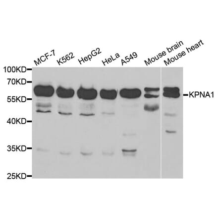 Western blot - KPNA1 Antibody from Signalway Antibody (32410) - Antibodies.com