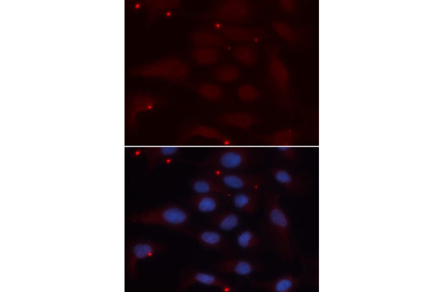 Immunofluorescence - KPNA1 Antibody from Signalway Antibody (32410) - Antibodies.com