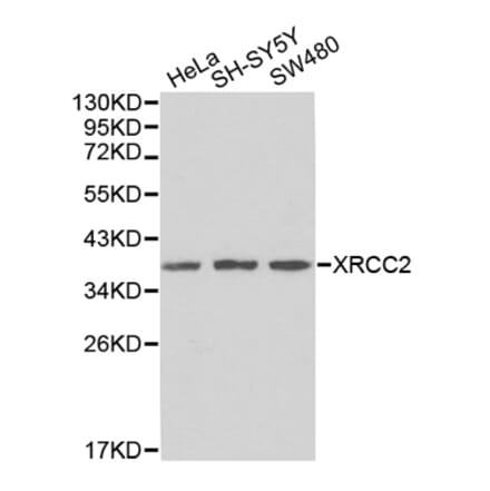 Western blot - XRCC2 Antibody from Signalway Antibody (32440) - Antibodies.com