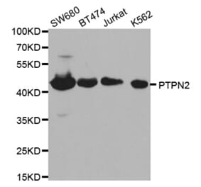 Western blot - PTPN2 Antibody from Signalway Antibody (32444) - Antibodies.com