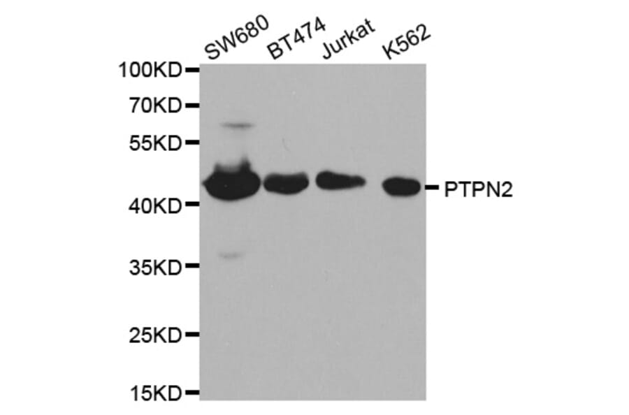 Western blot - PTPN2 Antibody from Signalway Antibody (32444) - Antibodies.com