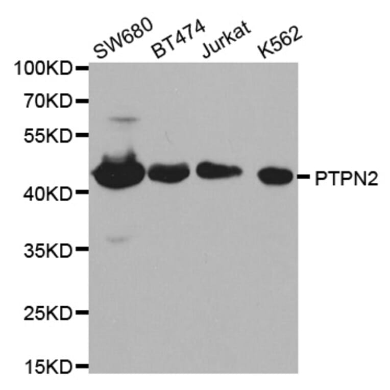 Western blot - PTPN2 Antibody from Signalway Antibody (32444) - Antibodies.com