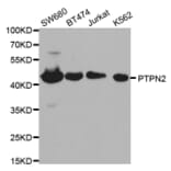 Western blot - PTPN2 Antibody from Signalway Antibody (32444) - Antibodies.com