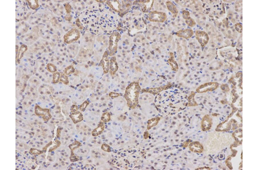 Immunohistochemistry - PTPN2 Antibody from Signalway Antibody (32444) - Antibodies.com