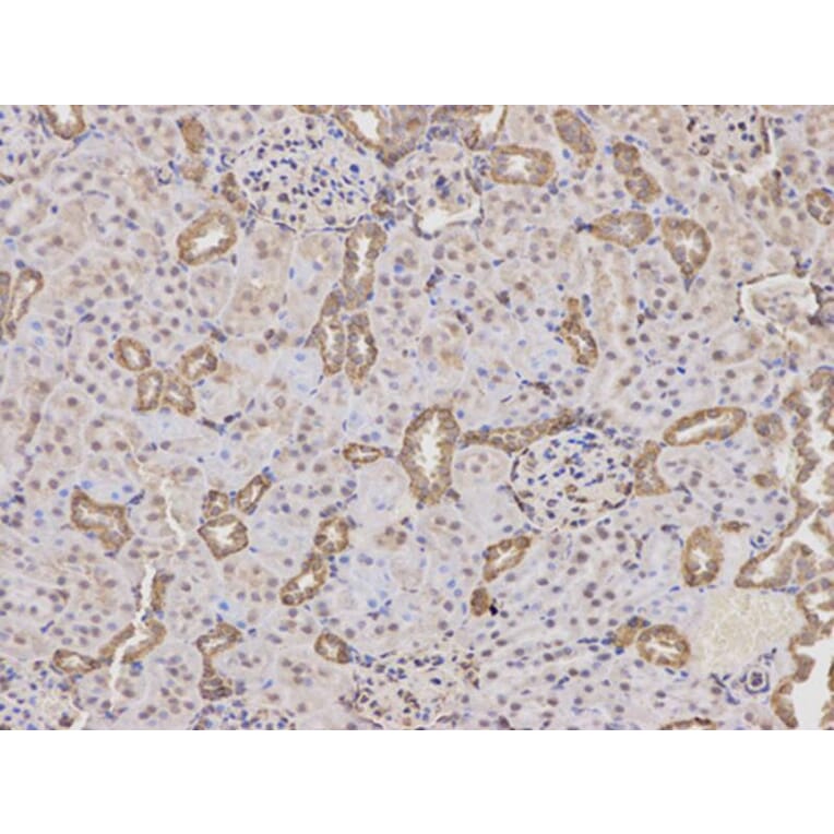 Immunohistochemistry - PTPN2 Antibody from Signalway Antibody (32444) - Antibodies.com