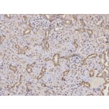 Immunohistochemistry - PTPN2 Antibody from Signalway Antibody (32444) - Antibodies.com