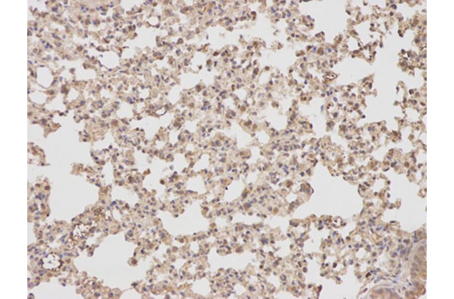 Immunohistochemistry - PTPN2 Antibody from Signalway Antibody (32444) - Antibodies.com