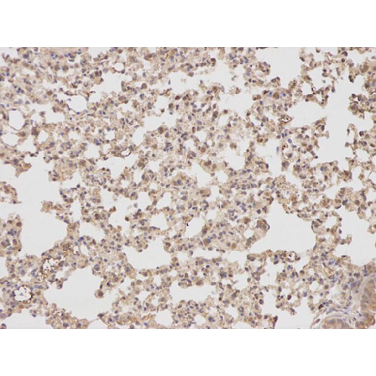 Immunohistochemistry - PTPN2 Antibody from Signalway Antibody (32444) - Antibodies.com